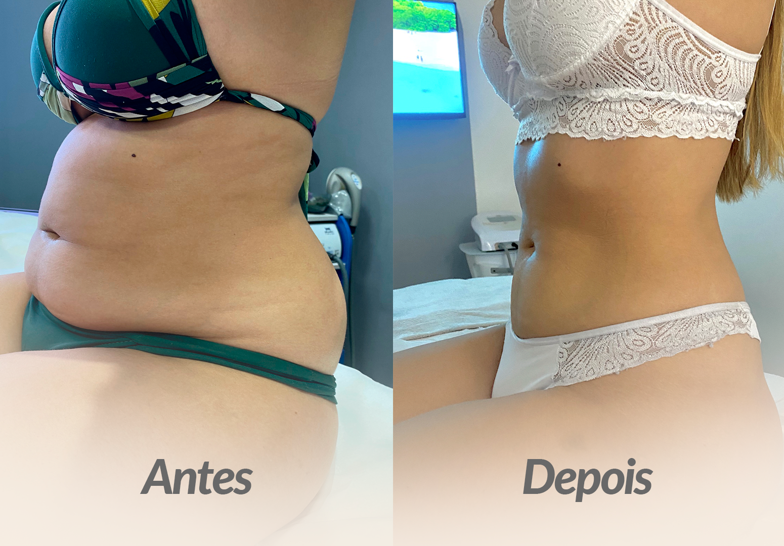 ABDOMEN-PACIENTE-1.png