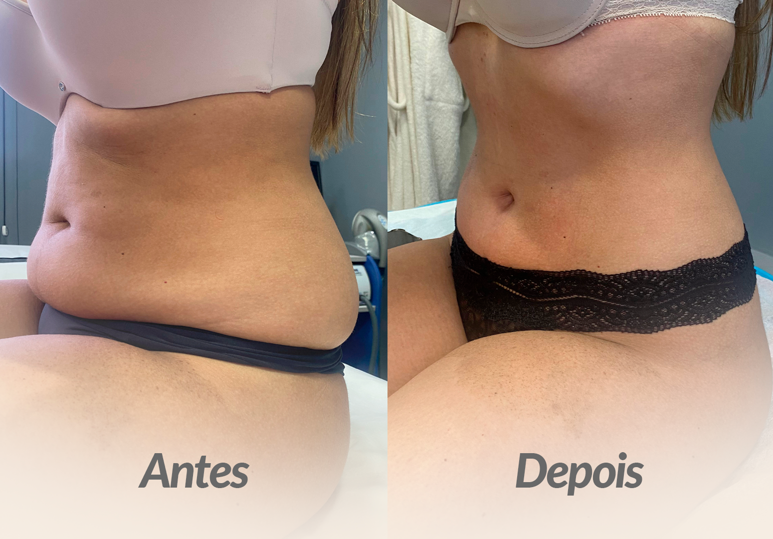 ABDOMEN-PACIENTE-3.png