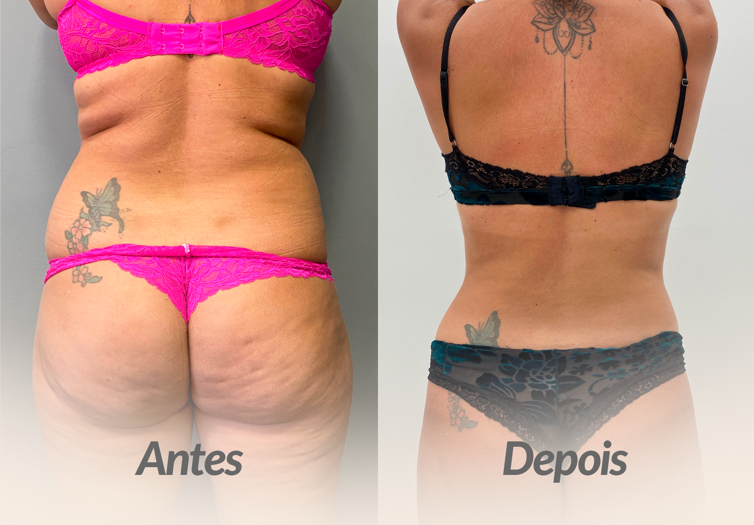 ANTES-E-DEPOIS-FERNADA.png