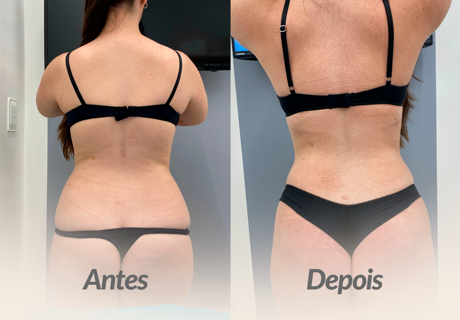 ANTES-E-DEPOIS-LOANA.png