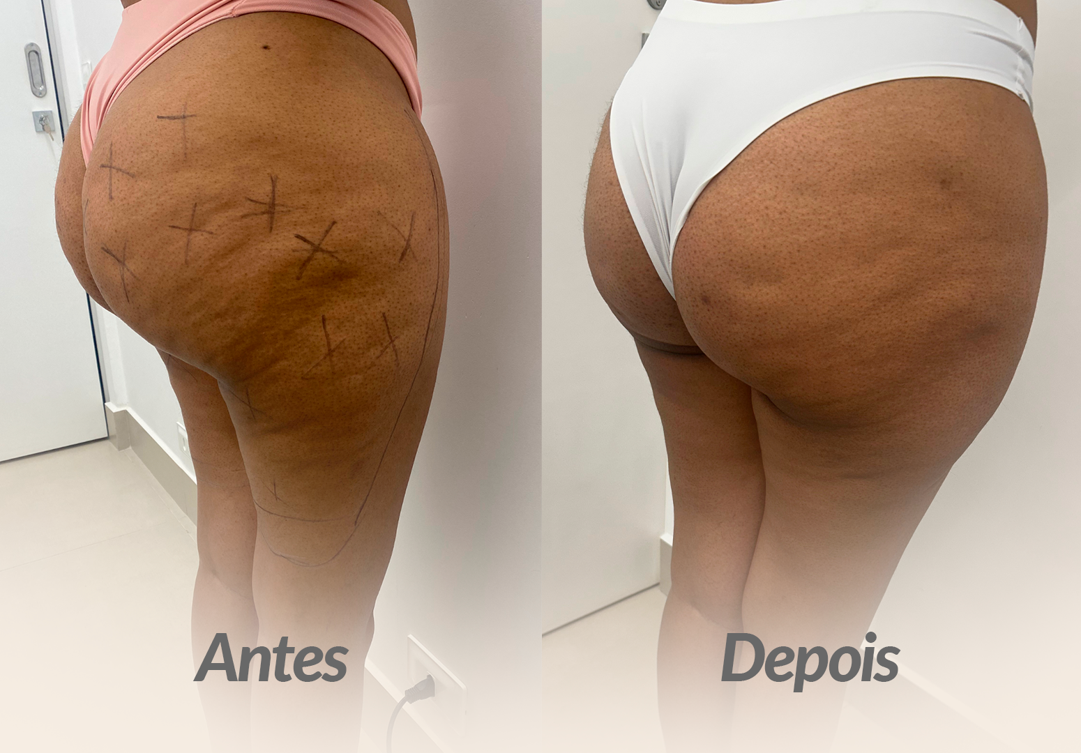 ANTES-E-DEPOIS-MONICA.png